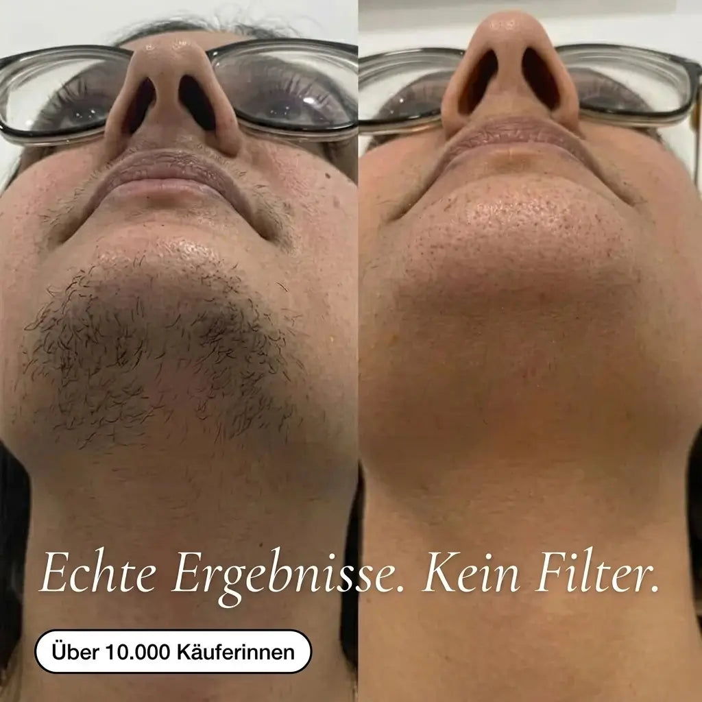 Pflanzliches Anti-Haarwuchs Serum