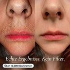 Pflanzliches Anti-Haarwuchs Serum