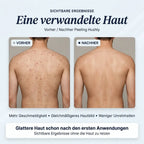 Hushly Peeling Duschtuch